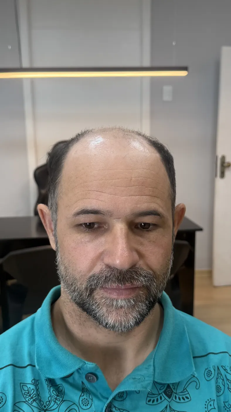Antes