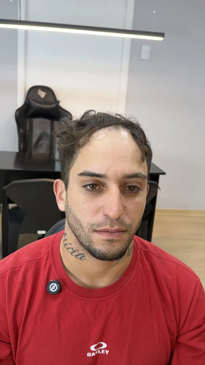 Antes